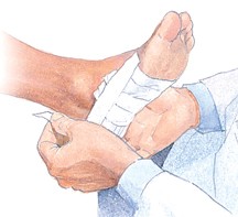 Heel pain treatment in Barrie