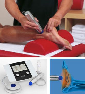 Shockwave Therapy in Barrie, ON